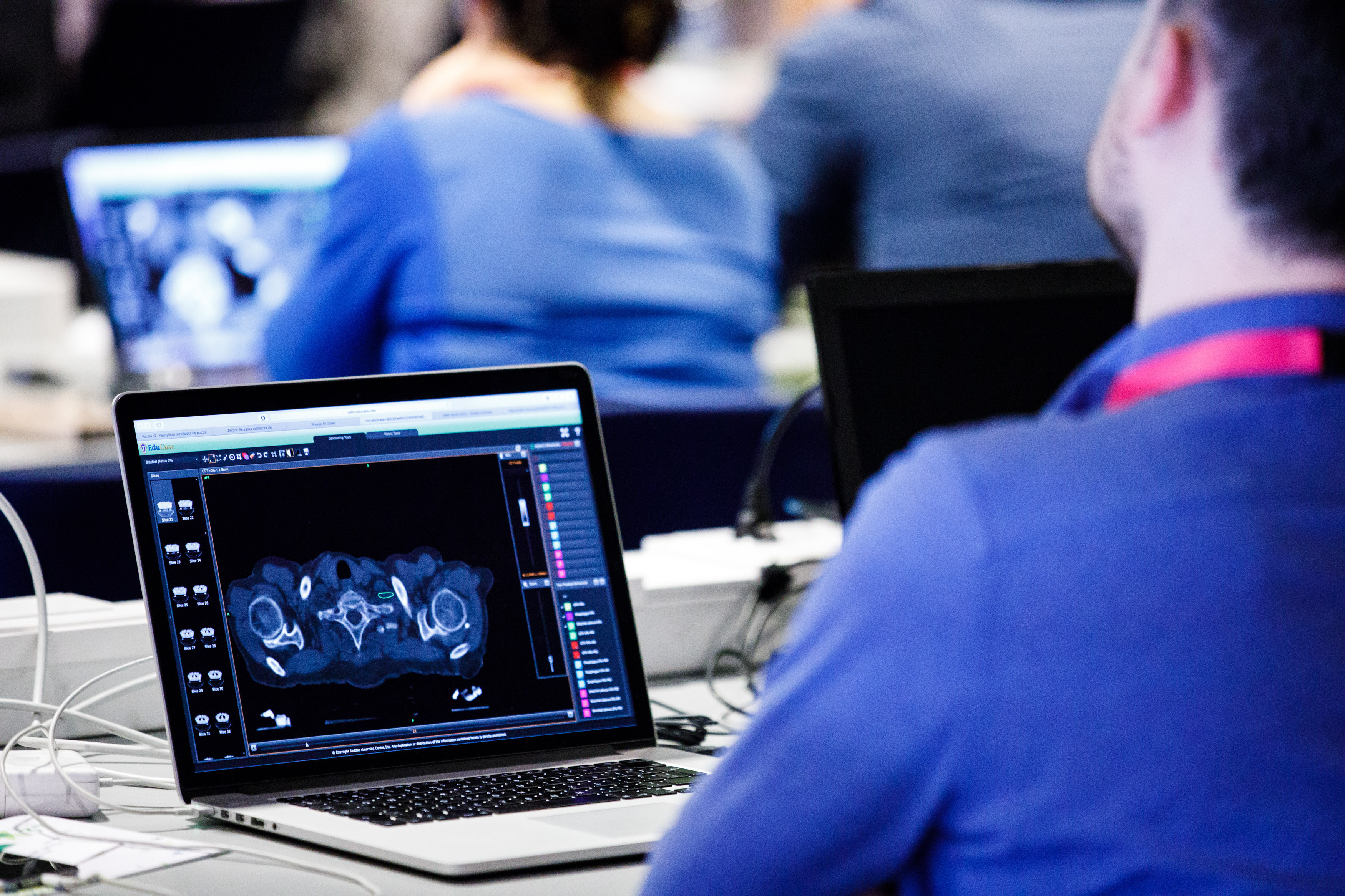 Falcon Workshop on Prostate SBRT
