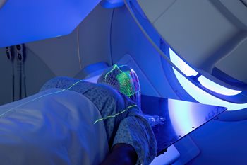 Vrouw-die-radiotherapie-ontvangt-hoofd.jpg