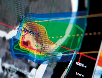 Online-Teaching-Particle-Therapy-3.jpg Online-Teaching-Particle-Therapy-3.jpg