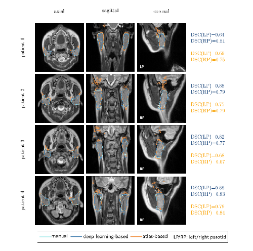 Kieselmann-Fig-1-(2).png